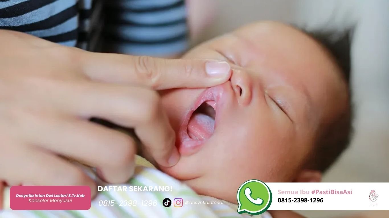 Cara Membersihkan Lidah Bayi Putih: Sisa Susu atau Jamur? | Bisa ASI cara membersihkan lidah bayi putih sisa susu atau jamur bisa asi